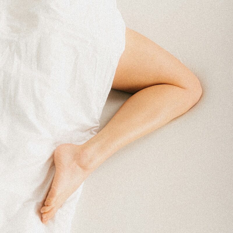 dyeVLLaser_RevitalizeHealthandWellness